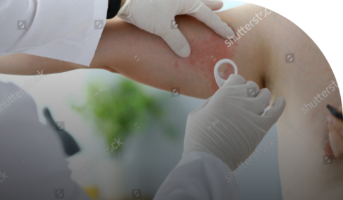 Leucemia