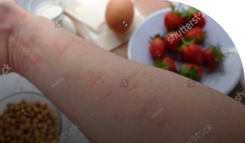 Leucemia