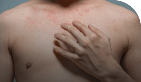 Signos y síntomas para identificar