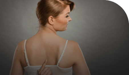 ¿Cuáles son los tipos de urticaria y en qué se diferencian?