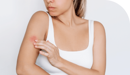 img UCE y sus causas