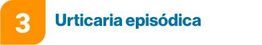 urticaria episodica