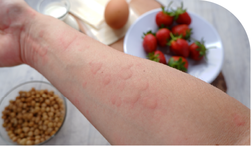 Comorbilidades Asociadas