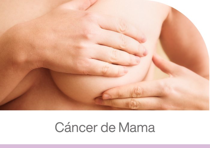 Mujer realizándose un autoexamen de mama