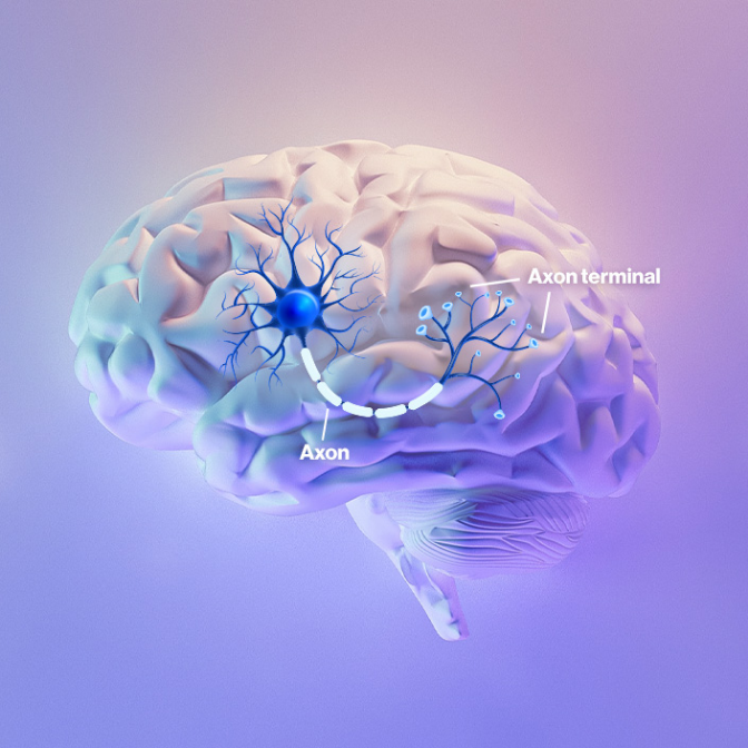 ¿Qué es la esclerosis múltiple?