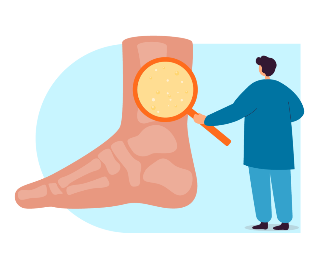 Leucemia