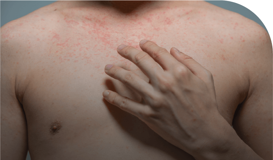 Signos y síntomas para identificar