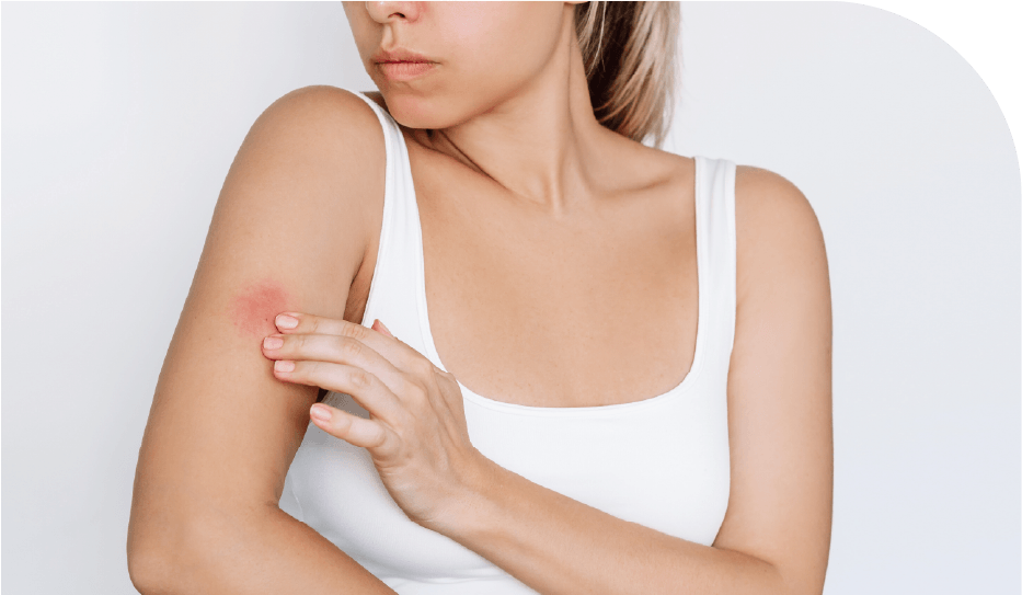 Urticaria: Ruta para identificar factores desencadenantes