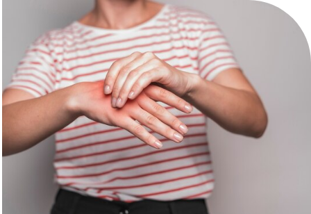 mitos urticaria mano