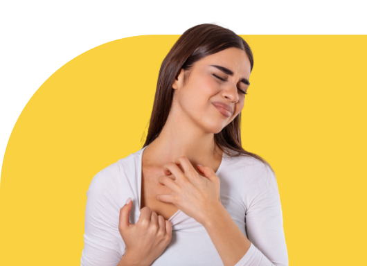  mitos y verdades sobre la urticaria