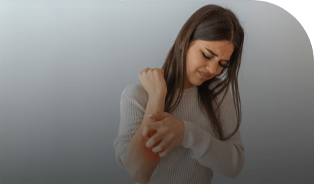 Urticaria crónica espontánea: Herramientas y consejos para identificar la enfermedad