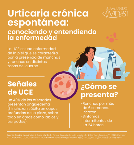 Urticaria crónica