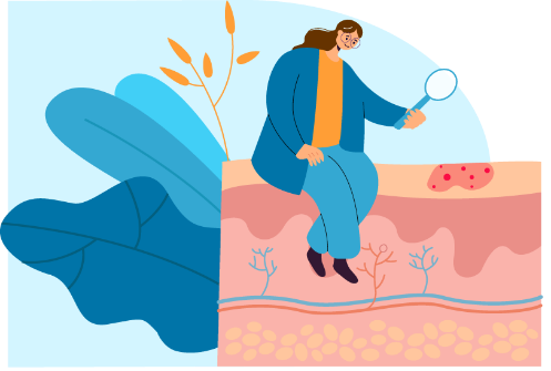 Urticaria Crónica