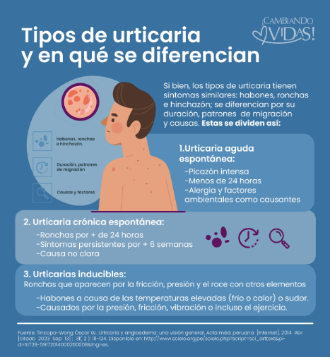 Urticaria: tipos y sub-tipos de manchas y habones