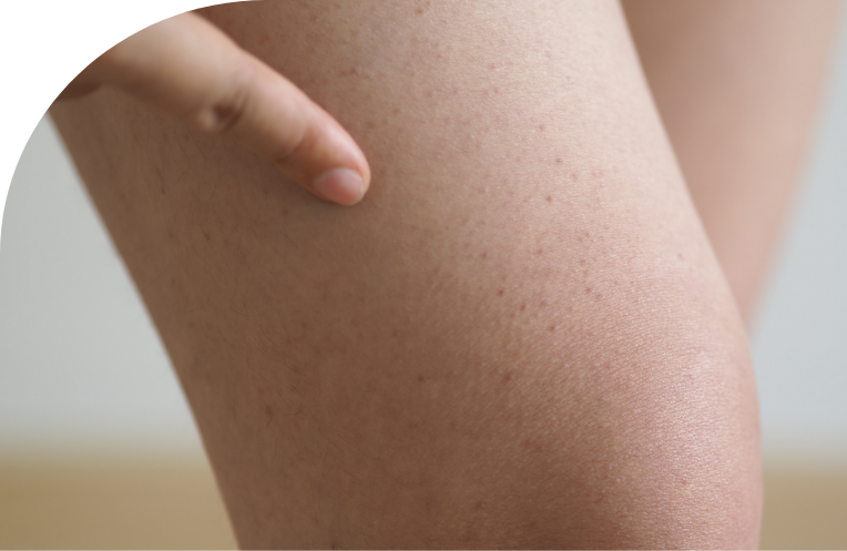 Trabajando con tu médico piernas