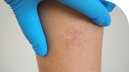 Ruta de atención y examen