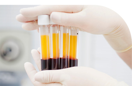 Trombocitopenia sangre