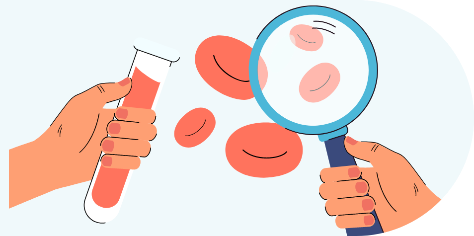 Trombocitopenia imagen de la izquierda