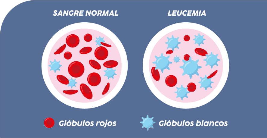 globulos blancos